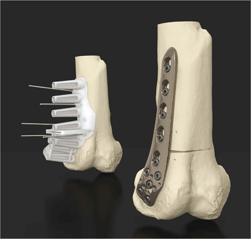 3D技术在生物医疗领域的八大进展（二）